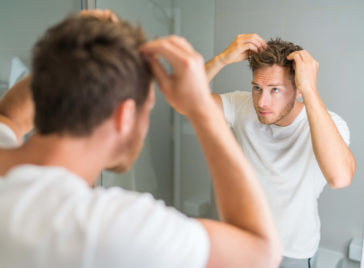 Hair Loss