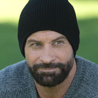 After Beard Transplants at Medihair