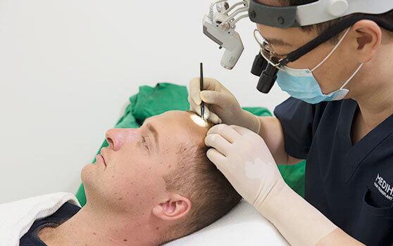 Medihair FUT Hair Transplant Surgeon