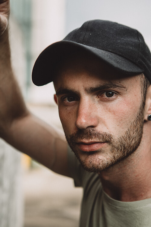 young man with beard transplants