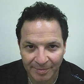 After Hair Transplant