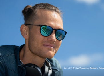 FUE Hair Transplant Patient Rohan After Surgery Image