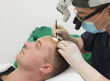 Hair Transplant Procedure