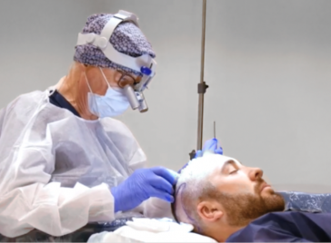 Hair Transplant Surgery